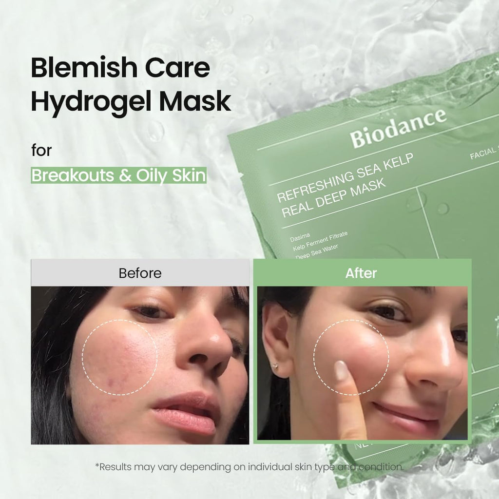 BIODANCE Bio-Collagen Real Deep Mask, Hydrating Overnight Hydrogel Mask, Pore Minimizing, Elasticity, Plumping Improvement, Korean Skincare | 1.19oz(34g) x 4ea