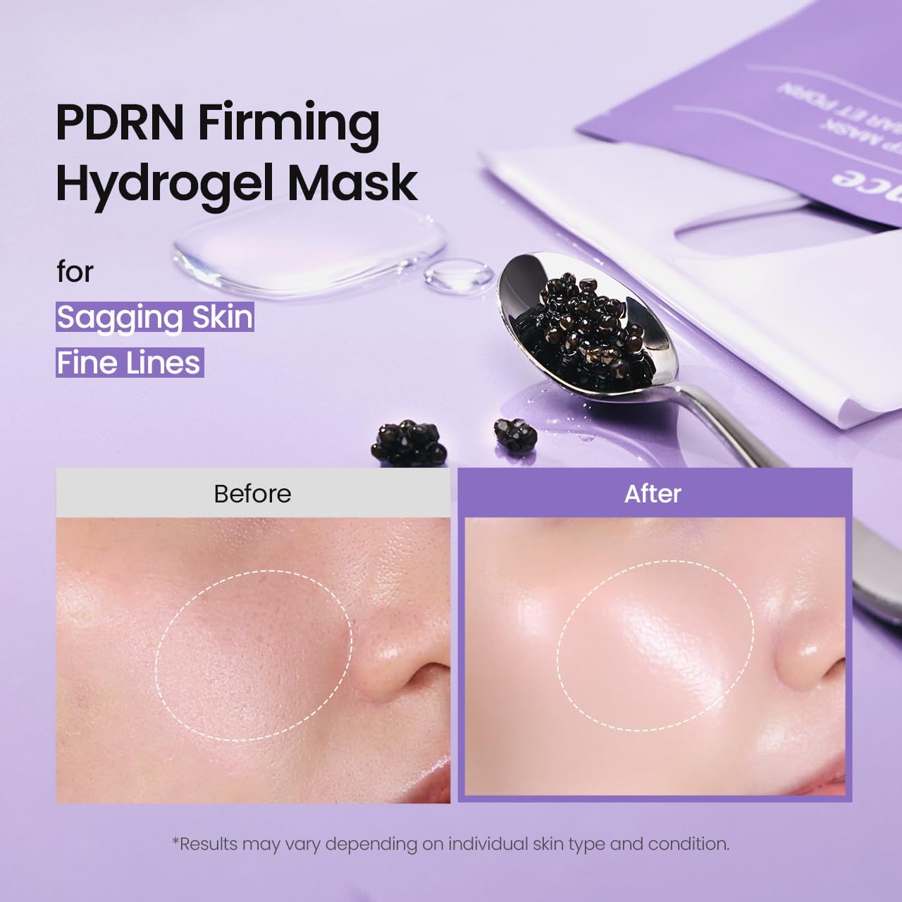 BIODANCE Bio-Collagen Real Deep Mask, Hydrating Overnight Hydrogel Mask, Pore Minimizing, Elasticity, Plumping Improvement, Korean Skincare | 1.19oz(34g) x 4ea