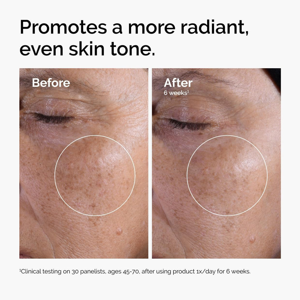 The Ordinary Glycolic Acid 7% Exfoliating Toner, Brightening and Smoothing Daily Toner for More Even-Looking Skin Tone