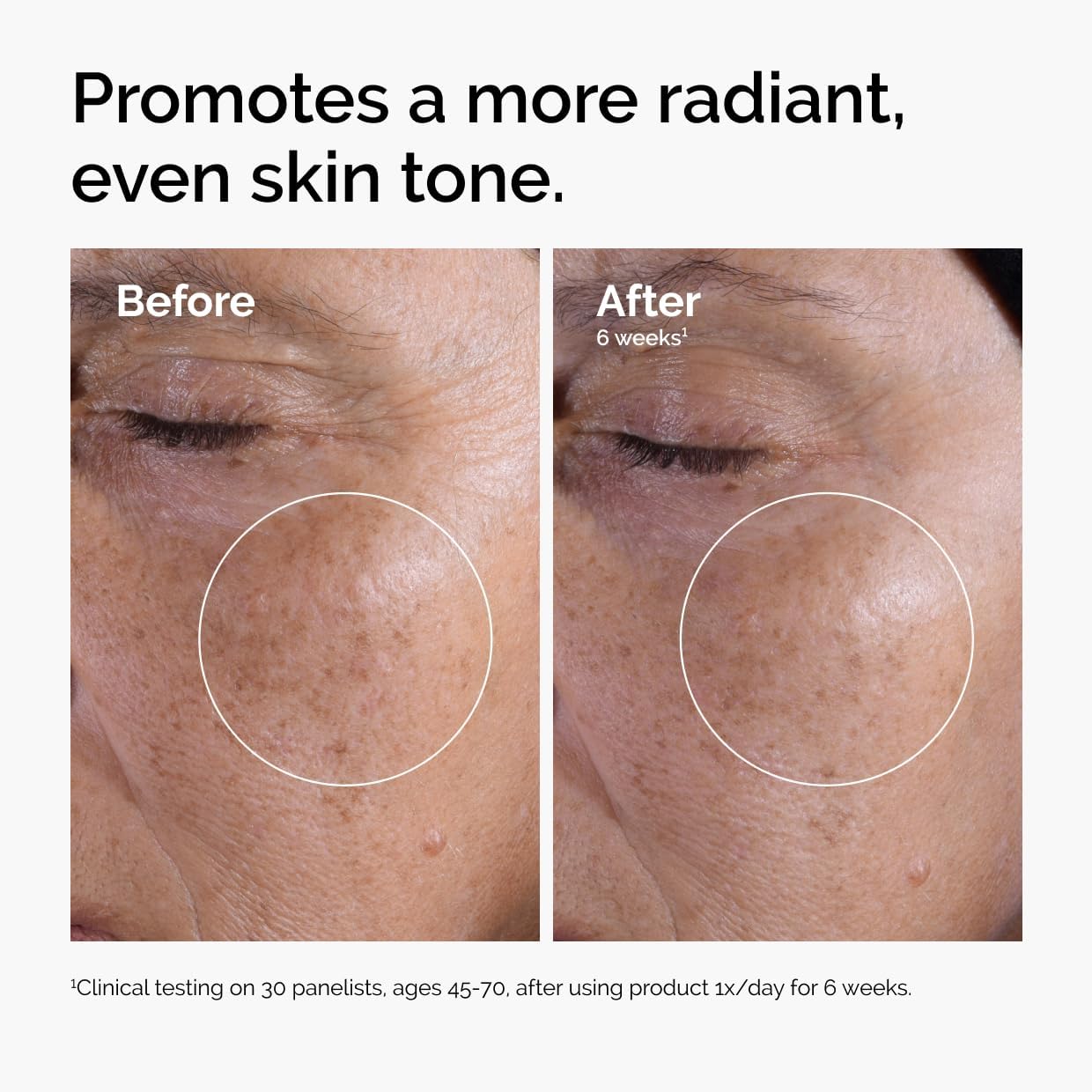 The Ordinary Glycolic Acid 7% Exfoliating Toner, Brightening and Smoothing Daily Toner for More Even-Looking Skin Tone