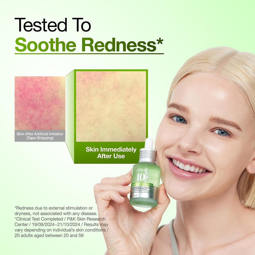 Anua Azelaic Acid 10 Hyaluron Redness Soothing Serum, 30ml