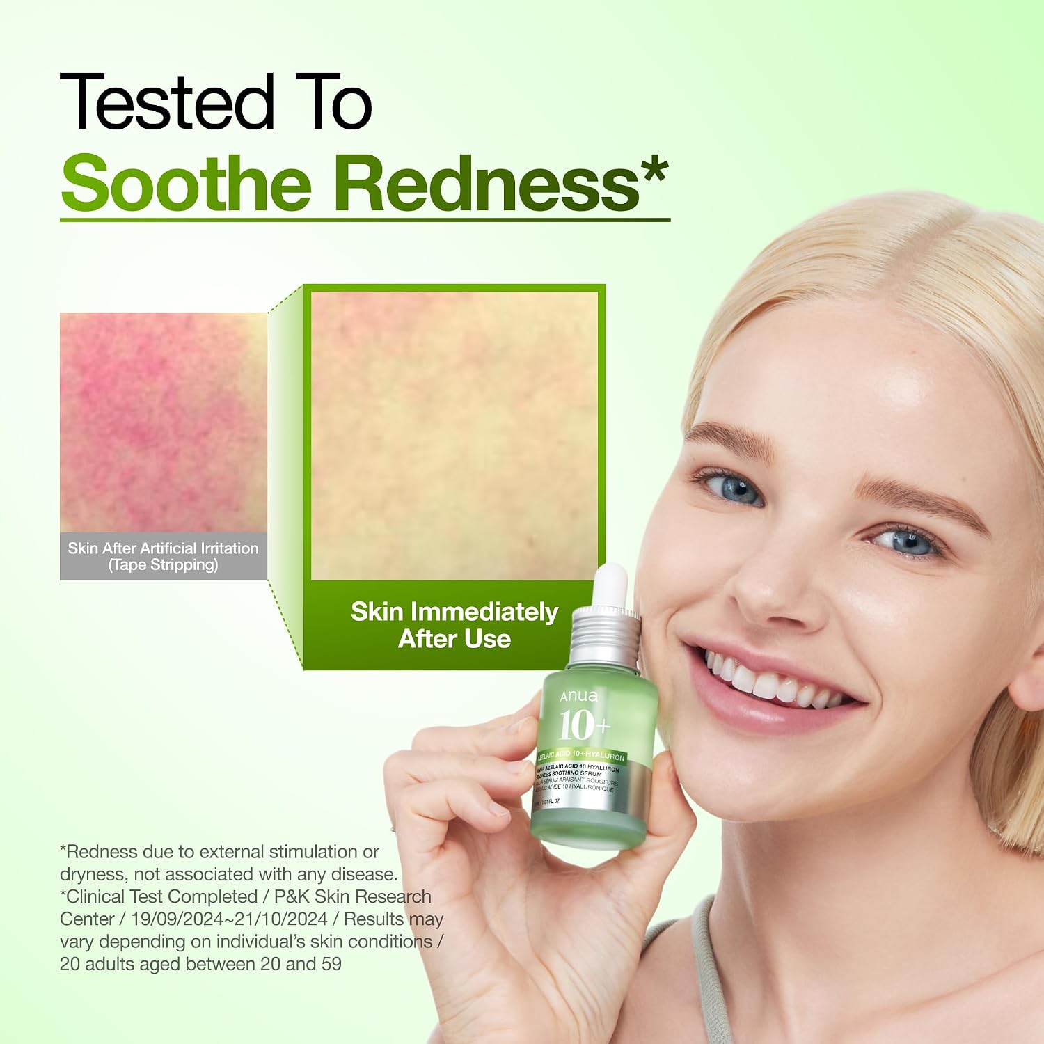Anua Azelaic Acid 10 Hyaluron Redness Soothing Serum, 30ml