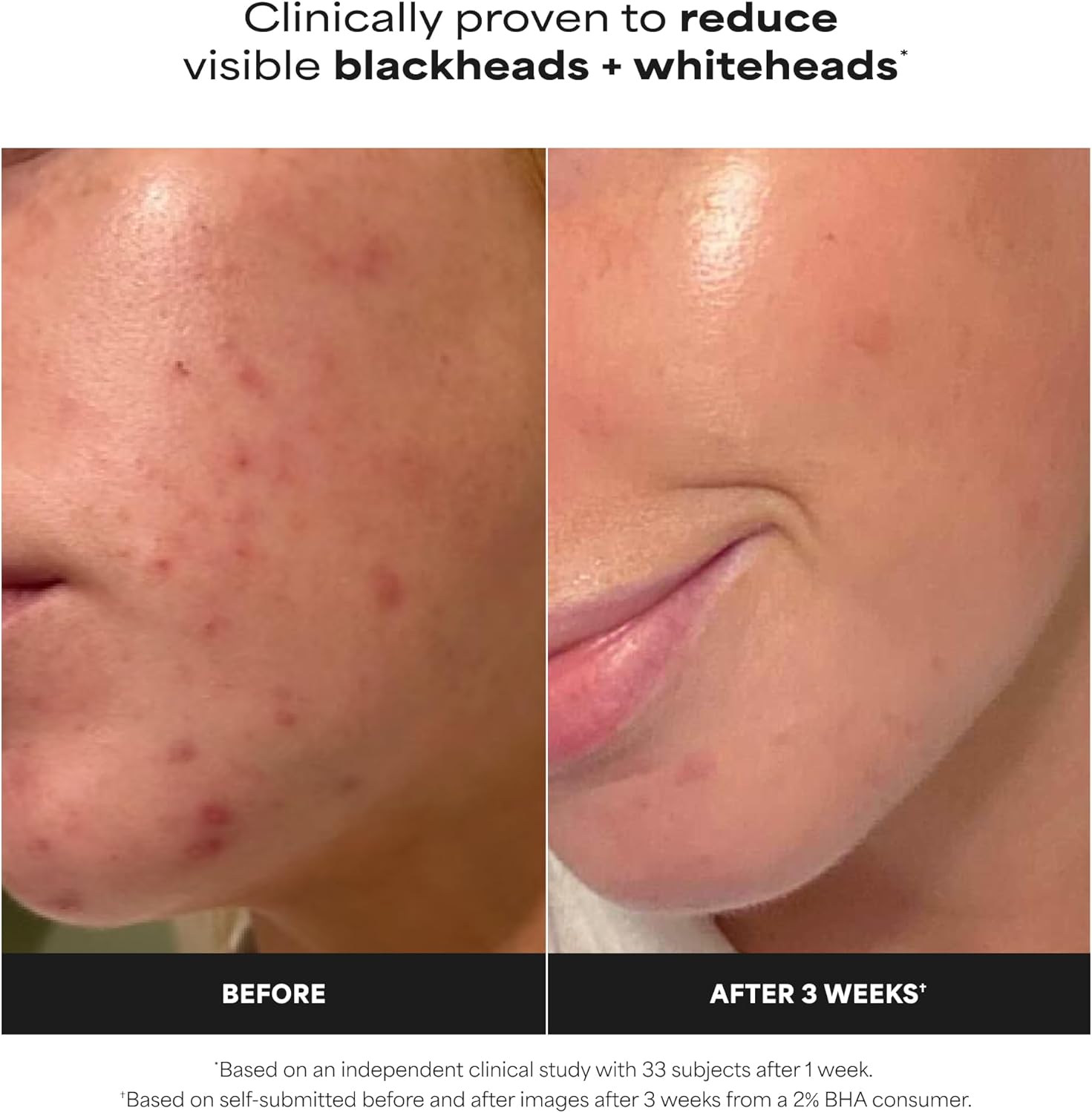 Paula's Choice SKIN PERFECTING 2% BHA Liquid Exfoliant, 30 mL, Travel Size