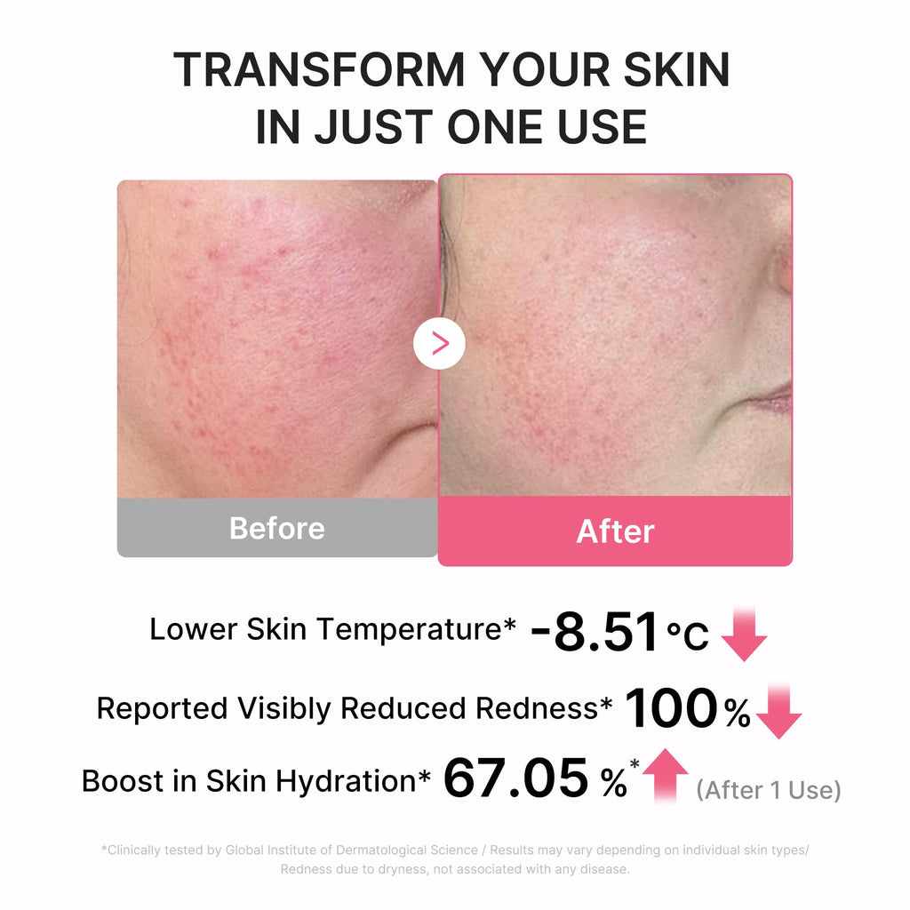 medicube Toner Pads Zero Pore Pad 2.0 for Exfoliation and Pore Care