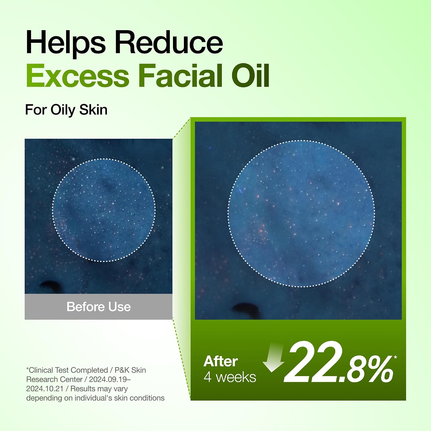 Anua Azelaic Acid 10 Hyaluron Redness Soothing Serum, 30ml
