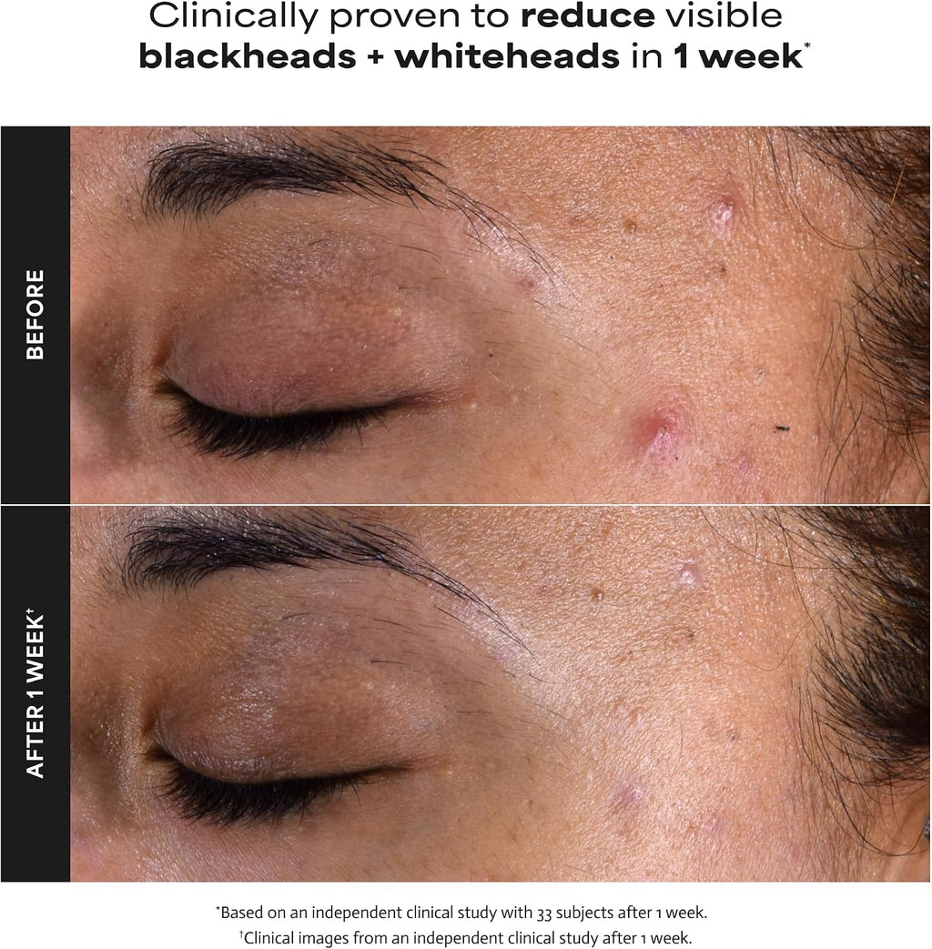 Paula's Choice SKIN PERFECTING 2% BHA Liquid Exfoliant, 30 mL, Travel Size