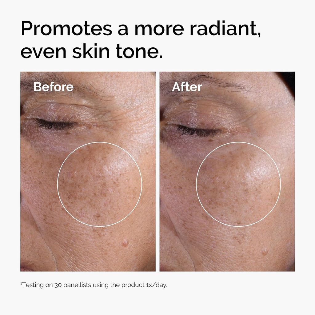 The Ordinary Glycolic Acid 7% Exfoliating Toner, Brightening and Smoothing Daily Toner for More Even-Looking Skin Tone